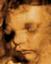 3D and 4D Ultrasounds by Ultrasona Columbus 