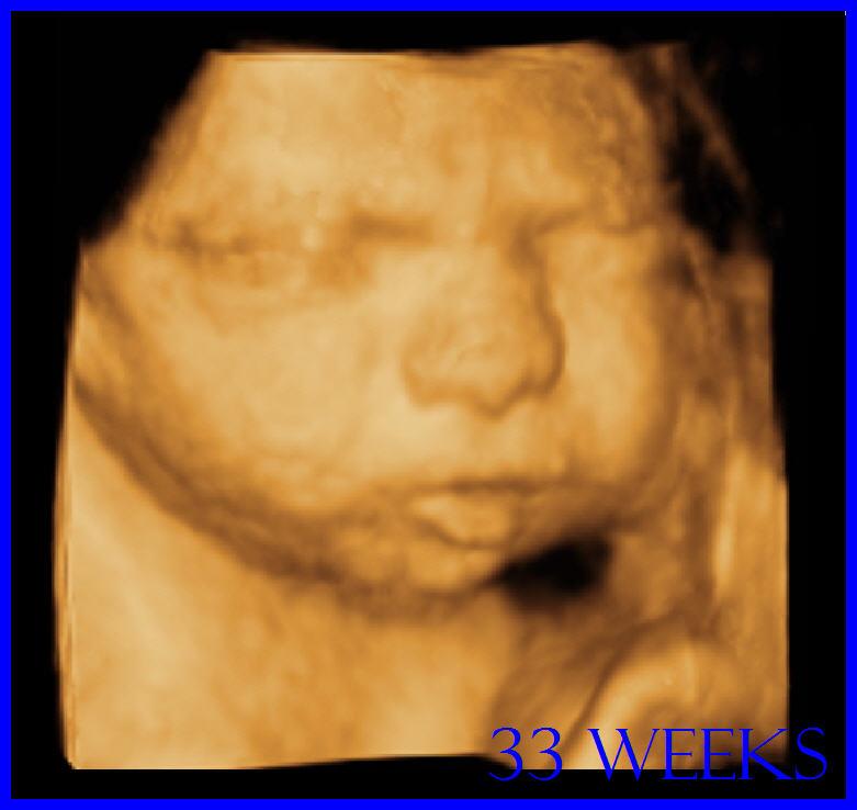 by Baby's First Image 3D/4D ULTRASOUND