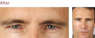 by Temecula Med Spa Temecula 92591 