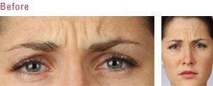  by Temecula Med Spa Temecula 92591 