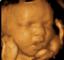 Ultraview Imaging