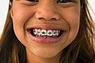  by AmeriPlan - Affordable Dental and Health Benefits Arlington 76017 