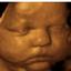 Baby Expressions 3D/4D Ultrasound