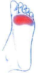 Orthotics mesa AZ ORTHOTICS GILBERT AZ CUSTOM ORTHOTICS Orthotics mesa AZ ORTHOTICS GILBERT AZ CUSTOM ORTHOTICS