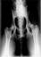 X-Ray Film Buyer (210)286-1790
