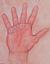Whidbey Island Hand & Lymphedema...