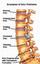 Provided by Colorado Comprehensive Spine Institute, Englewood 