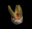 Provided by Elm Endodontics, Denver 