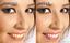 Provided by Heritage Dental, Pleasantville 