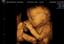 GoldenView Ultrasound 3D and 4D