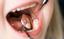 Provided by Confident Smile Dental, Belvidere 