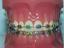 Provided by Georgia Orthodontic Studio, Lithonia 
