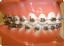 Provided by Georgia Orthodontic Studio, Lithonia 
