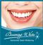 Provided by Teeth Whitening by Elyse, Encino 