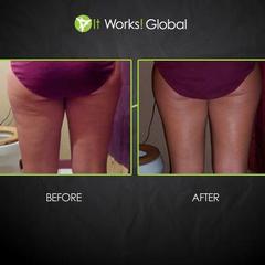 it works body wraps in gardner ks cellulite treatment 913 484 it works wraps cellulite reviews