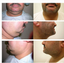 Provided by Cosmetic and Reconstructive Surgery Center, Arlington Heights 