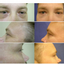 Provided by Cosmetic and Reconstructive Surgery Center, Arlington Heights 