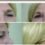 Provided by Cosmetic and Reconstructive Surgery Center, Arlington Heights 