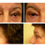 Provided by Cosmetic and Reconstructive Surgery Center, Arlington Heights 
