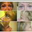 Provided by Cosmetic and Reconstructive Surgery Center, Arlington Heights 