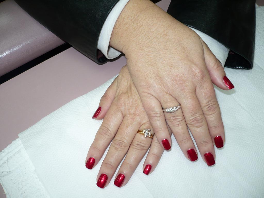 Nail Bed Description*^