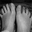 Advanced Care Foot & Ankle