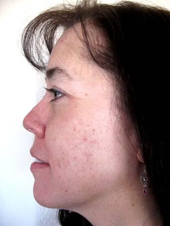 Side view before use of skin care.jpg by Test And See