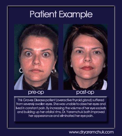 Dr Michael J Yaremchuk Boston Ma 02116 617 726 5280 Cosmetics