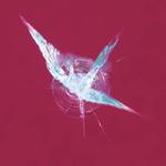 repair 2 by First Choice Windshield Repair