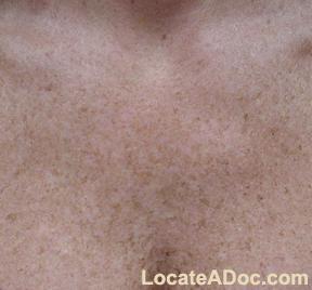 Pictures for CNT SKIN CARE & LASER HAIR REMOVAL in Scottsdale, AZ 85258