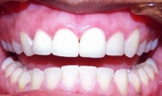 cosmetic dentist Florence SC by Richard L Nash DDS