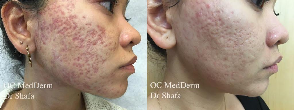  by OC MedDerm