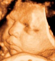 Clear Image 4D Ultrasound : Brooklyn Pregnancy Center