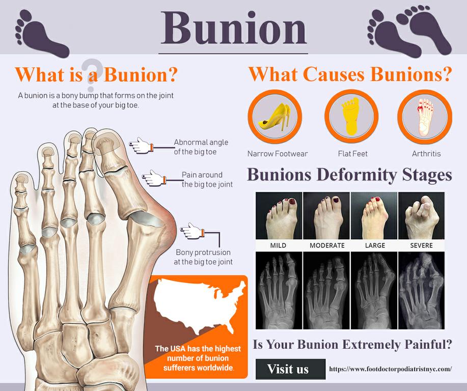  by Manhattan Foot Specialists (Union Square)