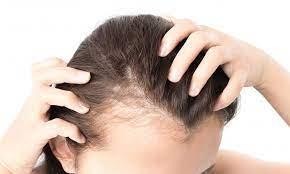 hair-loss by Assure Cosmetic Studio