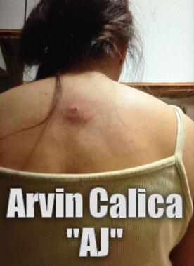  by Arvin Calica Domestikong karahasan