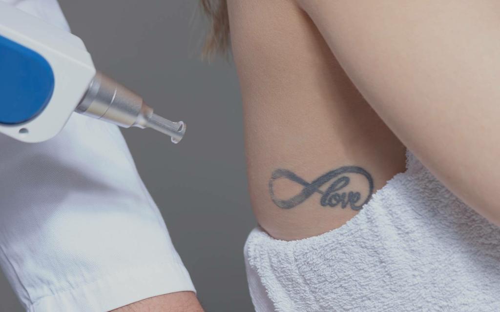 svc5-laser-tattoo-removal-1 by Beauty SkinCare Spa