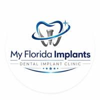 Dental Implants Port St Lucie